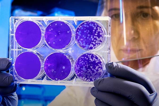 scientist observing petri dish